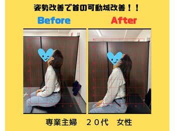 ナオル整体 本厚木院(NAORU)/猫背矯正で首の可動域UP！！