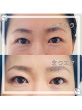 ナイン ゴー(Nine go)/バインドロック