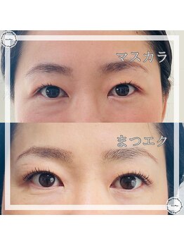 ナイン ゴー(Nine go)/バインドロック