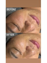 ニーナアイプラス(nina eye+)/