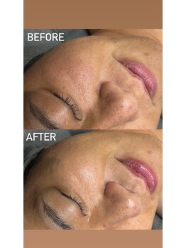 ニーナアイプラス(nina eye+)/