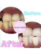 エクシアホワイト SOKA(ecxia white)/