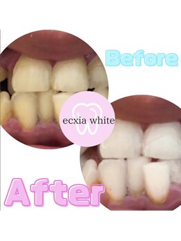 エクシアホワイト SOKA(ecxia white)/