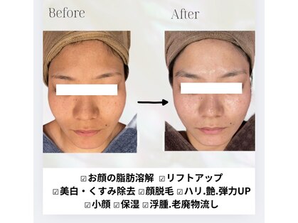 カリス(charis)の写真