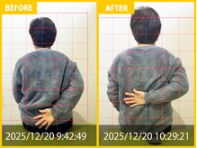 整体院 元 宇城松橋店/五十肩の悩み