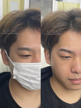 プラスアイビー 沖縄那覇店(+i.b)/HBL☆before/after