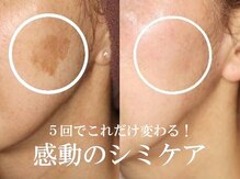 ヴィーナスハート