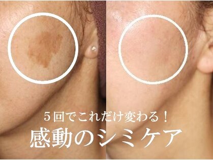 ヴィーナスハートの写真