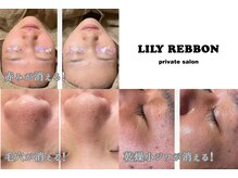 Private salon LILY REBBON