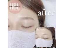 ユニゾン(Unison)/ハリウッドブロウリフト中百舌鳥