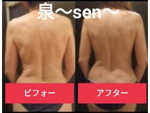 リコメンス(Recommence)/背面矯正