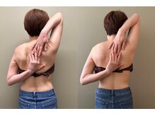 マイティー整骨院 ココア(CoCoa)/肩甲骨洗浄