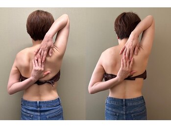 マイティー整骨院 ココア(CoCoa)/肩甲骨洗浄