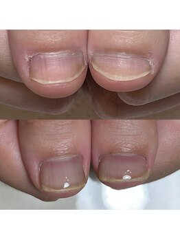 リヒネイル(Rihi.nail)/自爪育成