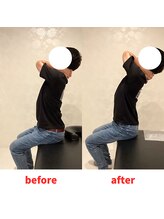 ナオル整体 福岡香椎院(NAORU整体)/30代男性施術事例【猫背】