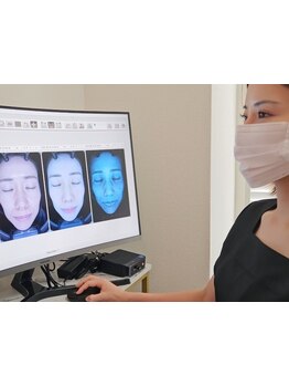 シミしわ改善！予防ケア