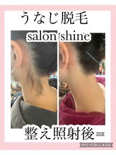 サロンシャイン(Salon Shine)/うなじ脱毛