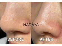 肌屋(HADA-YA)/3D毛穴バイオ洗浄