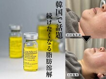 リコス(LICCO’S)の雰囲気（Vラインフェイス、二重顎解消を叶えるレモンボトル導入★）