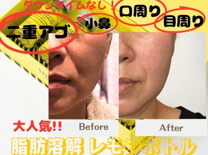 オーシャン(OCEAN)の写真