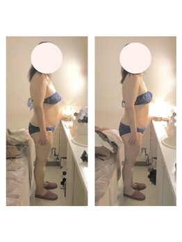 アクア エステティコ 亀有(ACQUA estetico)/脂肪燃焼 3ヶ月変化 50代