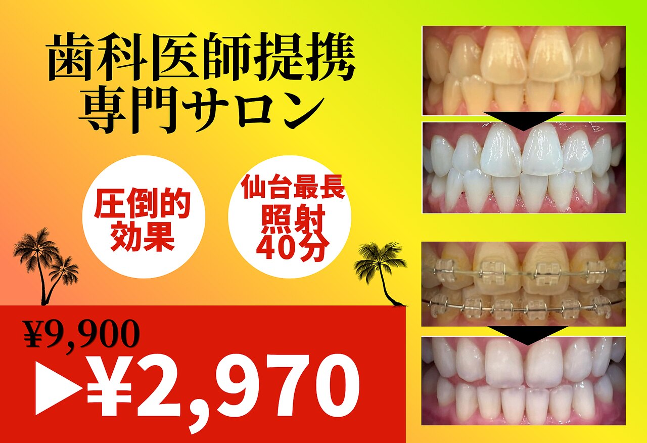 ホワイトニングショップ 北四番丁店｜ホットペッパービューティー