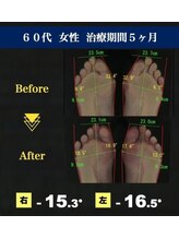 サラ(SARA)/