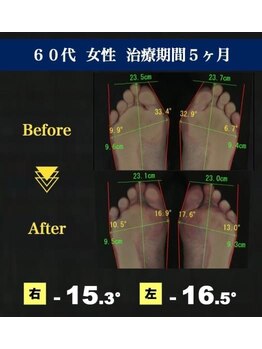 サラ(SARA)/