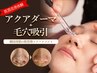 【新規導入】エステ版アクアダーマ+小鼻の毛穴吸引　￥20,100→￥8,980
