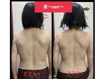 リコメンス(Recommence)/１回でもしっかり変化！