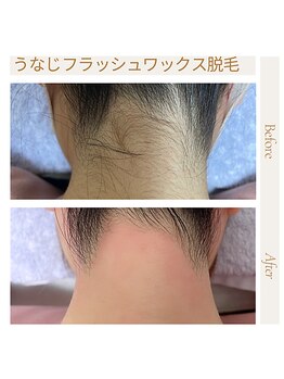 オフオルファヴォリ(OF Olu:Favori)/【フラッシュワックス脱毛】