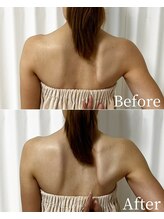 ユカリス(Yu.charis)/肩甲骨はがし　before→after