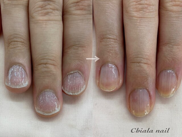 Chiala nail【キアラネイル】