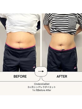 オーシャン整骨院(OCEAN整骨院)/３ヶ月ダイエットコース