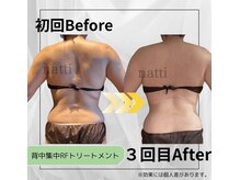 ナッティ(natti)/背面見返り美人メイク