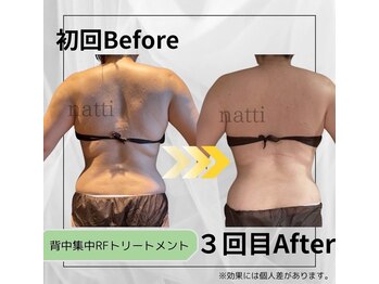 ナッティ(natti)/背面見返り美人メイク