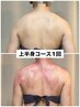 新規【平日限定】痩身＆肩こり改善”上半身”コース20分7,480→¥6,000