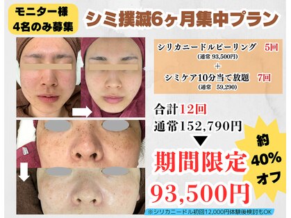 シュウ(Shuu)の写真