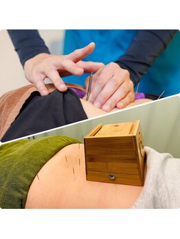 北てんま整骨鍼灸院/鍼灸施術