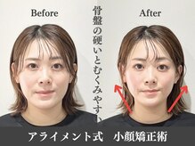 アライメント 恵比寿(Alignment)/むくみ改善♪