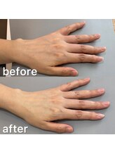 オテテ アイアンドハンド(otete eye&hand)/ハンドケアビフォーアフター