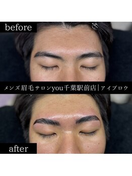 ユー 千葉駅前店(you)/ビフォ－アフター写真
