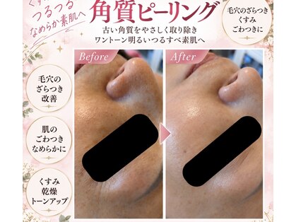 ステラ(Stella)の写真