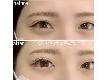 アイリス(EYELISS)/次世代まつげパーマ