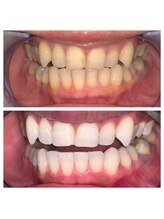 ライトビューティー 池袋店(LightBeauty)/症例写真