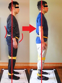 チャラク(charaku)/【40代N様：全身矯正|背骨湾曲】