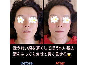 美容矯正サロン レレポノ(LELEPONO)/