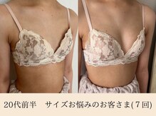 ラーナ(Lana)/【バストアップ】症例♪