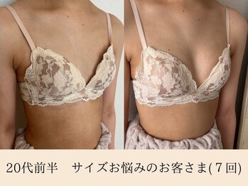 ラーナ(Lana)/【バストアップ】症例♪