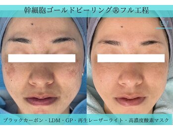 リメイク 広尾(REMAKE)/